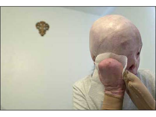 【图】注意交通安全!<em>美女车祸</em>前后<em>照片</em>,心理承