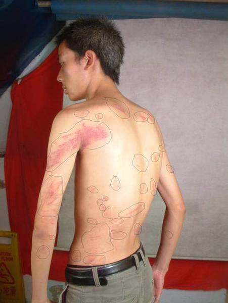 河北省邯郸市北方汽修学校发生教职工群殴学生,两同学 河北省邯郸市北方汽修学校发生教职工群殴学生,两同学